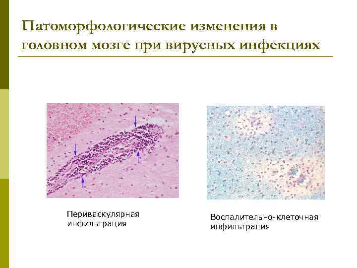 Патоморфологическая картина это