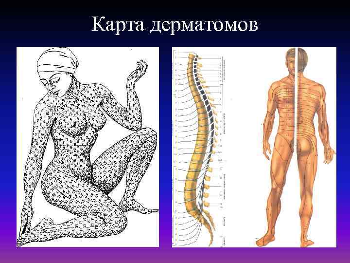 Карта дерматомов 