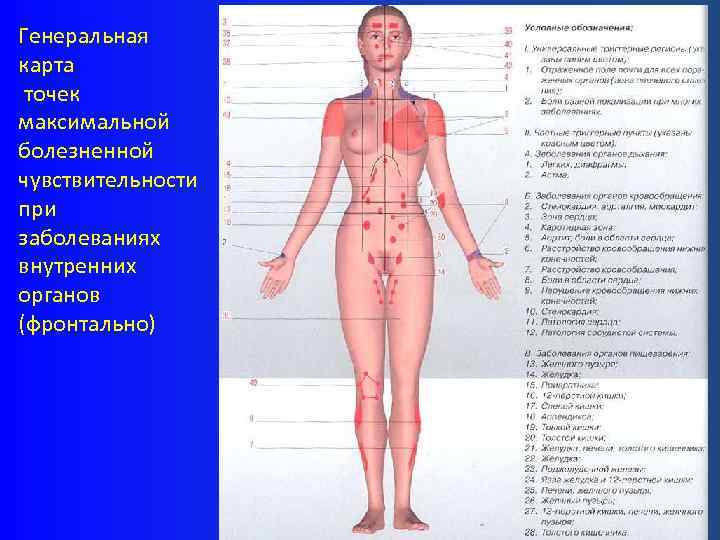 Генеральная карта точек максимальной болезненной чувствительности при заболеваниях внутренних органов (фронтально) 