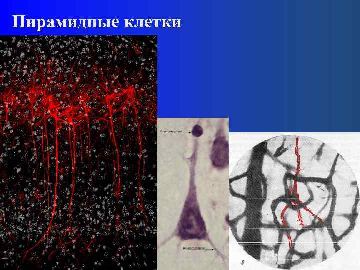 Пирамидные клетки 