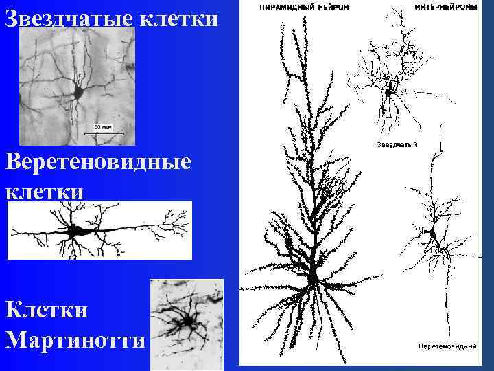 Звездчатые клетки Веретеновидные клетки Клетки Мартинотти 