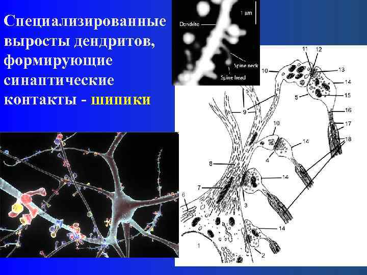 Специализированные выросты дендритов, формирующие синаптические контакты - шипики 