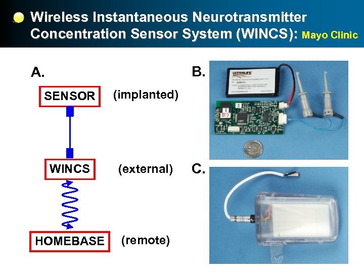 Wireless Instantaneous Neurotransmitter Concentration Sensor System (WINCS): Mayo Clinic B. A. SENSOR (implanted) WINCS