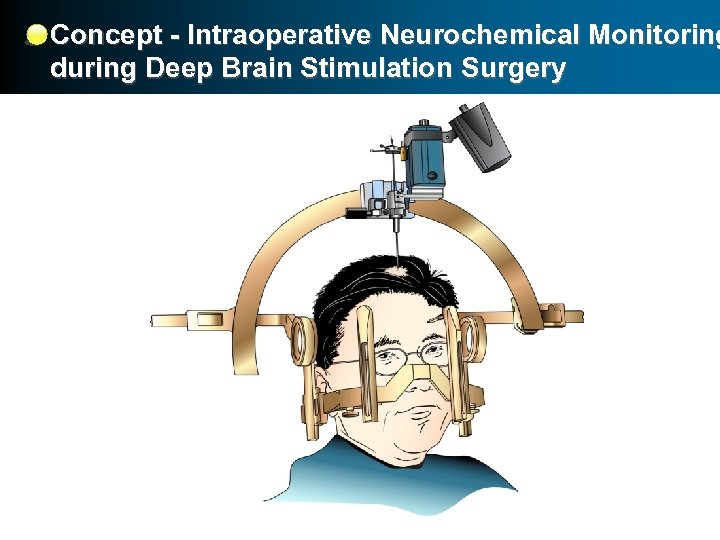 Concept - Intraoperative Neurochemical Monitoring during Deep Brain Stimulation Surgery 