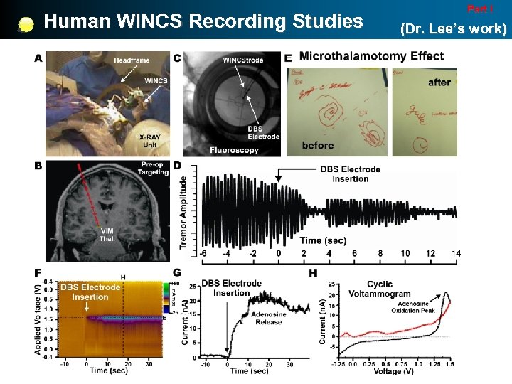 Human WINCS Recording Studies Part I (Dr. Lee’s work) 