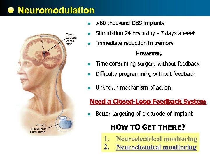 Neuromodulation n >60 thousand DBS implants n Stimulation 24 hrs a day - 7