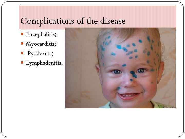 Complications of the disease Encephalitis; Myocarditis; Pyoderma; Lymphadenitis. 