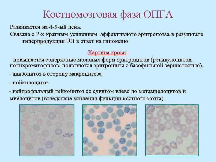 Картина крови при опга