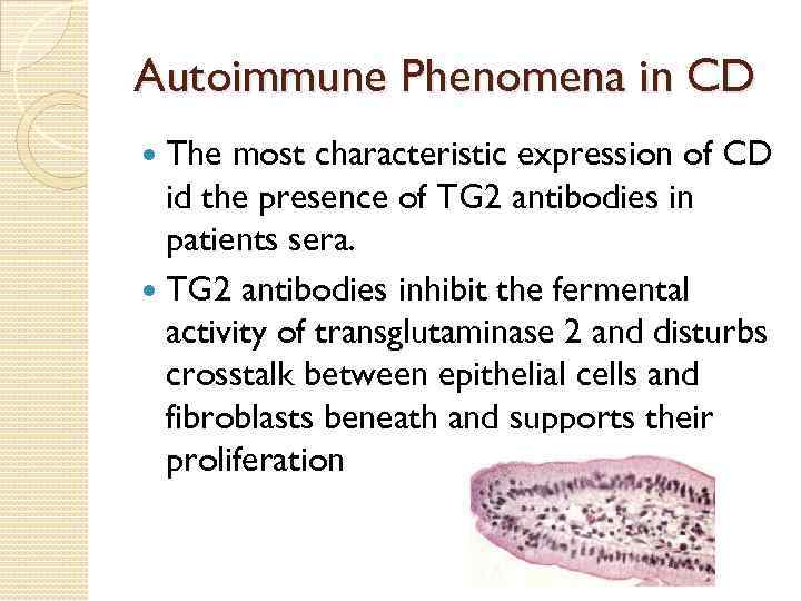 Autoimmune Phenomena in CD The most characteristic expression of CD id the presence of