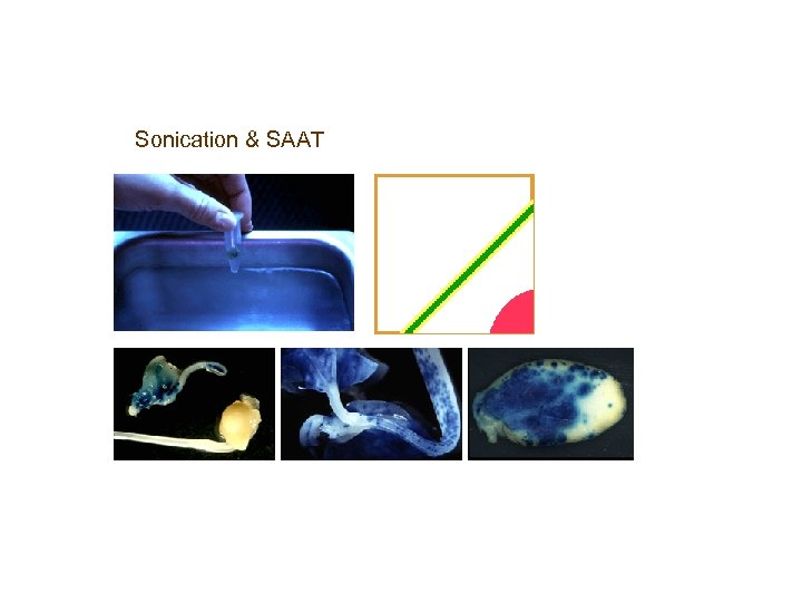 Sonication & SAAT 