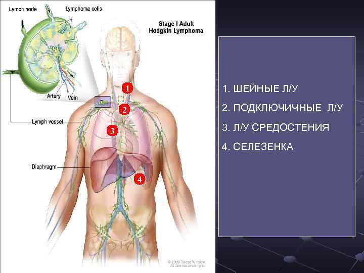 1. ШЕЙНЫЕ Л/У 1 2. ПОДКЛЮЧИЧНЫЕ Л/У 2 3. Л/У СРЕДОСТЕНИЯ 3 4. СЕЛЕЗЕНКА