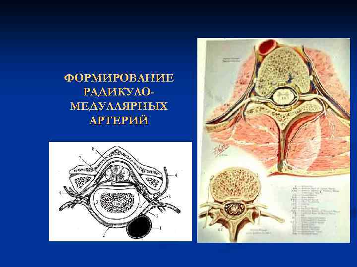 ФОРМИРОВАНИЕ РАДИКУЛОМЕДУЛЛЯРНЫХ АРТЕРИЙ 