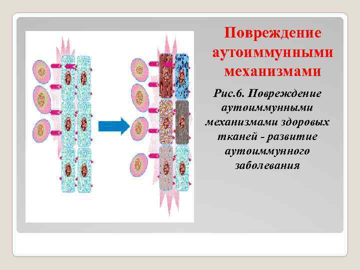 Повреждение аутоиммунными механизмами Рис. 6. Повреждение аутоиммунными механизмами здоровых тканей - развитие аутоиммунного заболевания