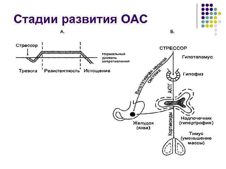 Стадии развития ОАС 