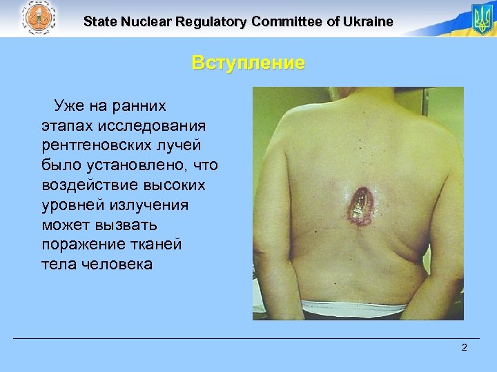 State Nuclear Regulatory Committee of Ukraine Вступление Уже на ранних этапах исследования рентгеновских лучей