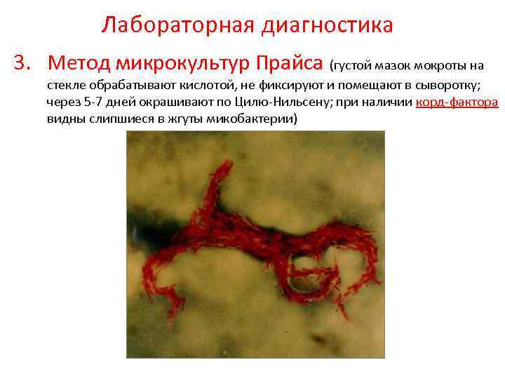 Лабораторная диагностика 3. Метод микрокультур Прайса (густой мазок мокроты на стекле обрабатывают кислотой, не