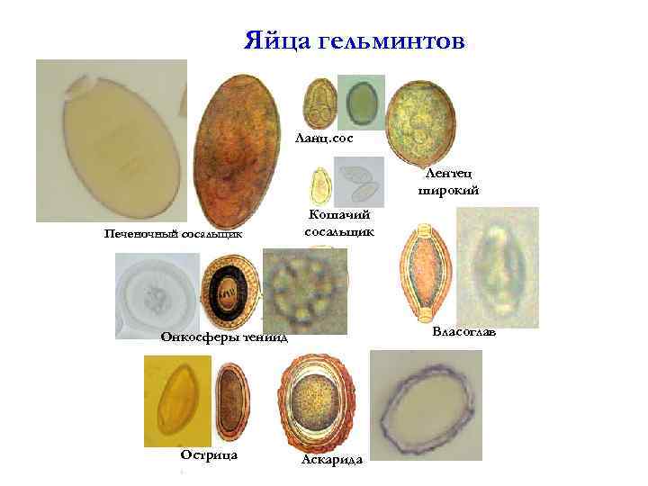 Яйца гельминтов Ланц. сос Лентец широкий Печеночный сосальщик Кошачий сосальщик Власоглав Онкосферы тениид Острица