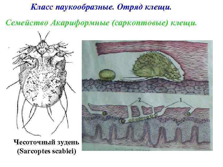 Класс паукообразные. Отряд клещи. Семейство Акариформные (саркоптовые) клещи. Чесоточный зудень (Sarcoptes scabiei) 