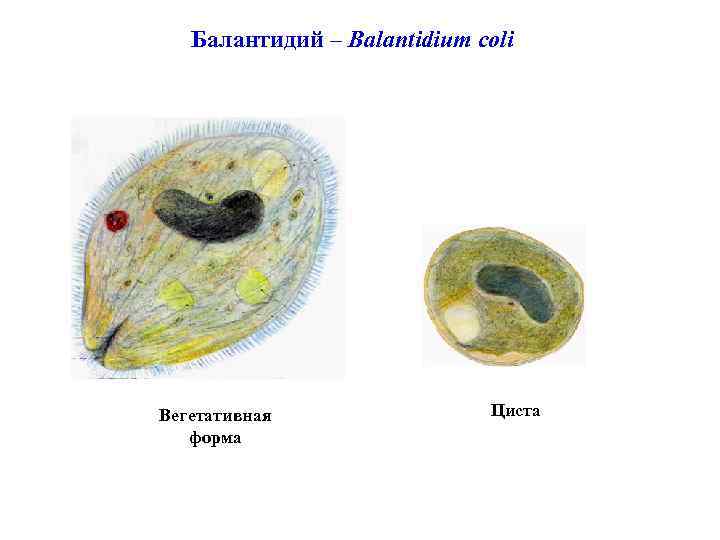 Балантидий – Balantidium coli Вегетативная форма Циста 