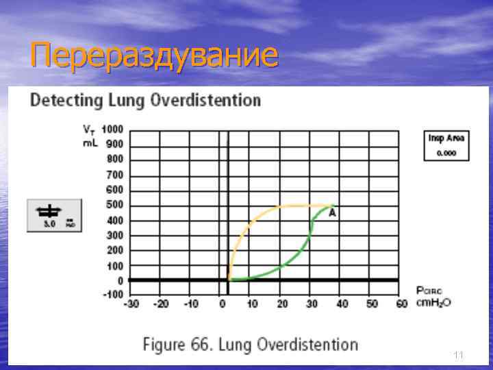 Перераздувание 11 
