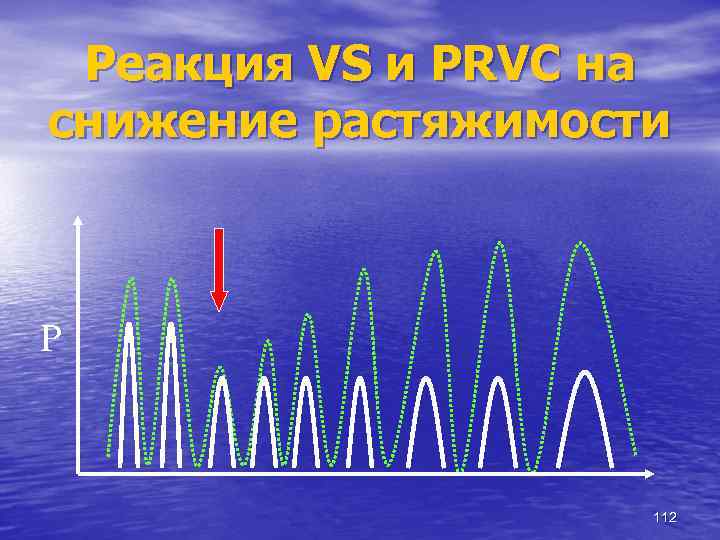 Реакция VS и PRVС на снижение растяжимости P 112 