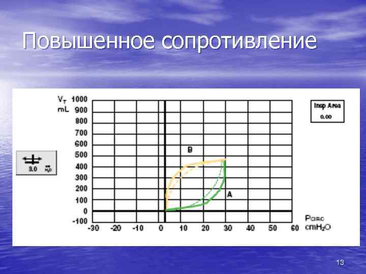 Повышенное сопротивление 13 