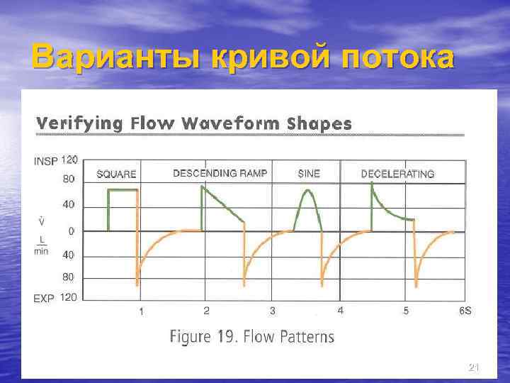Варианты кривой потока 21 