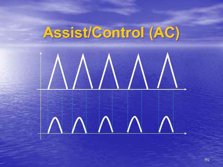 Assist/Control (AC) 69 