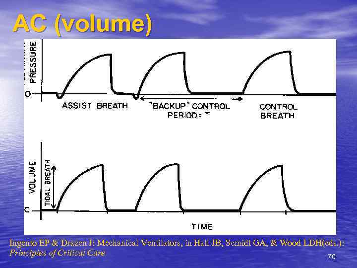 AС (volume) Ingento EP & Drazen J: Mechanical Ventilators, in Hall JB, Scmidt GA,