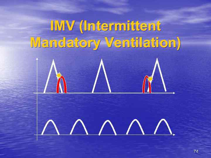 IMV (Intermittent Mandatory Ventilation) 74 