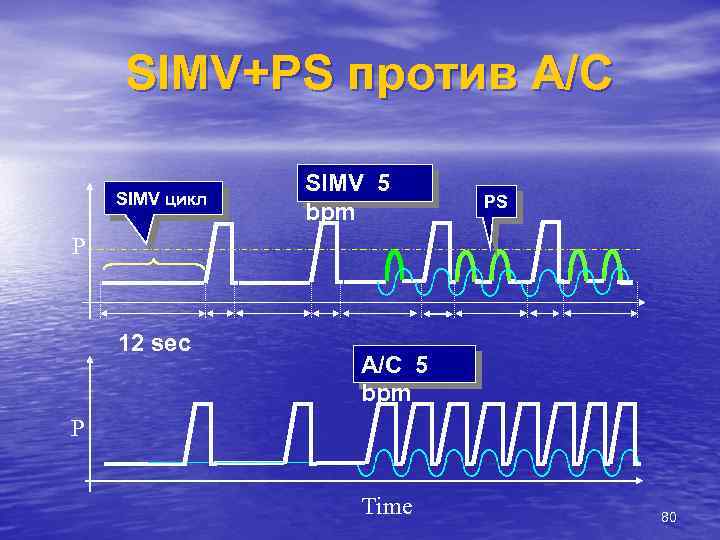 SIMV+PS против A/C SIMV цикл SIMV 5 bpm PS Р 12 sec A/C 5