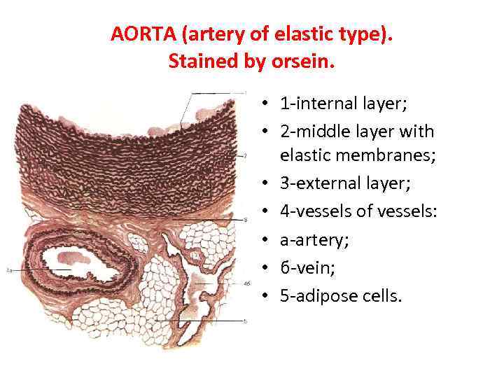 AORTA (artery of elastic type). Stained by orsein. • 1 -internal layer; • 2