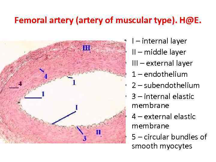 Femoral artery (artery of muscular type). H@E. I – internal layer II – middle