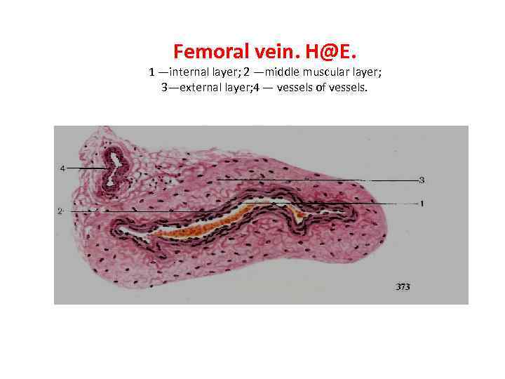 Femoral vein. H@E. 1 —internal layer; 2 —middle muscular layer; 3—external layer; 4 —