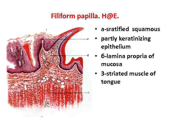 Filiform papilla. H@E. • a-sratified squamous • partly keratinizing epithelium • б-lamina propria of