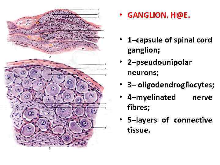  • GANGLION. H@E. • 1–capsule of spinal cord ganglion; • 2–pseudounipolar neurons; •