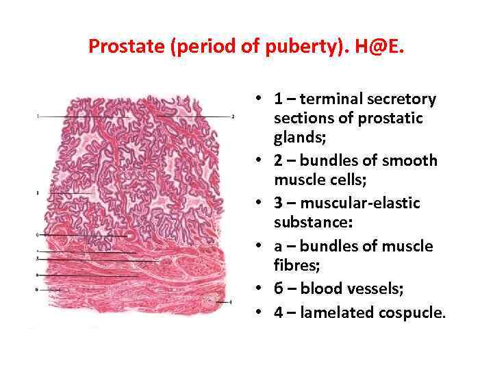 Prostate (period of puberty). H@E. • 1 – terminal secretory sections of prostatic glands;