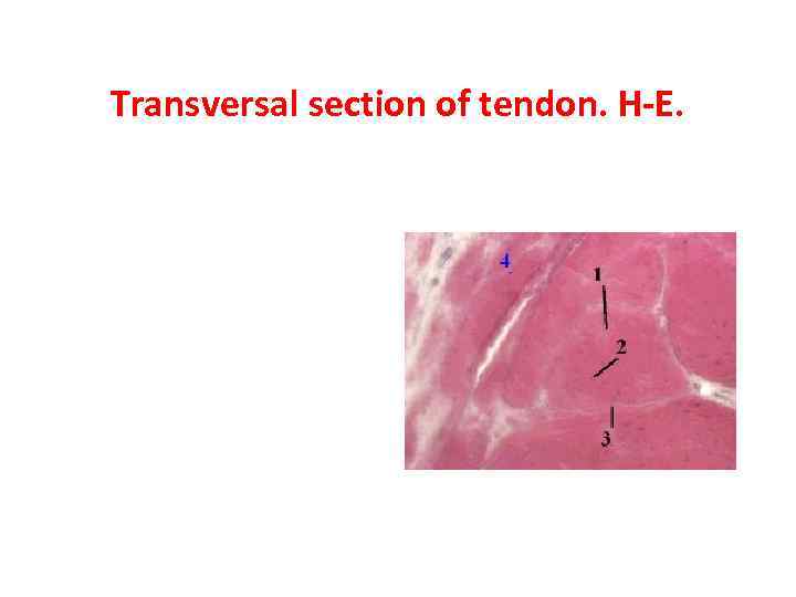 Transversal section of tendon. H-E. 
