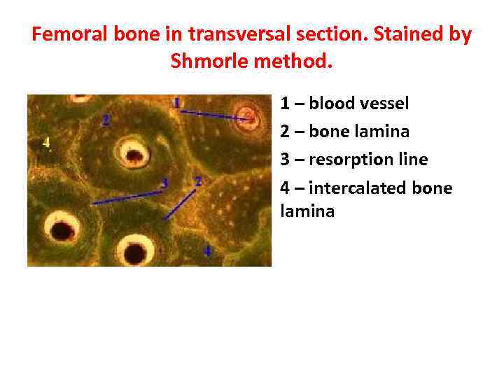 Femoral bone in transversal section. Stained by Shmorle method. 1 – blood vessel 2