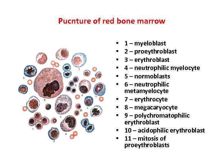 Pucnture of red bone marrow • • • 1 – myeloblast 2 – proeythroblast