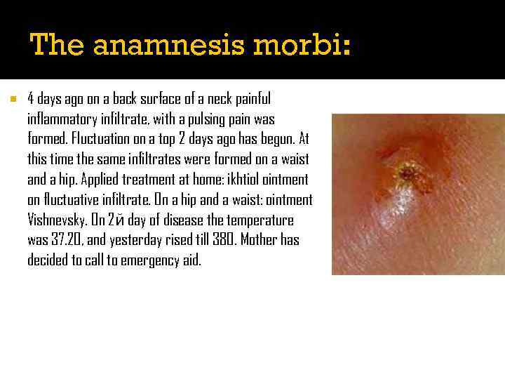 The anamnesis morbi: 4 days ago on a back surface of a neck painful