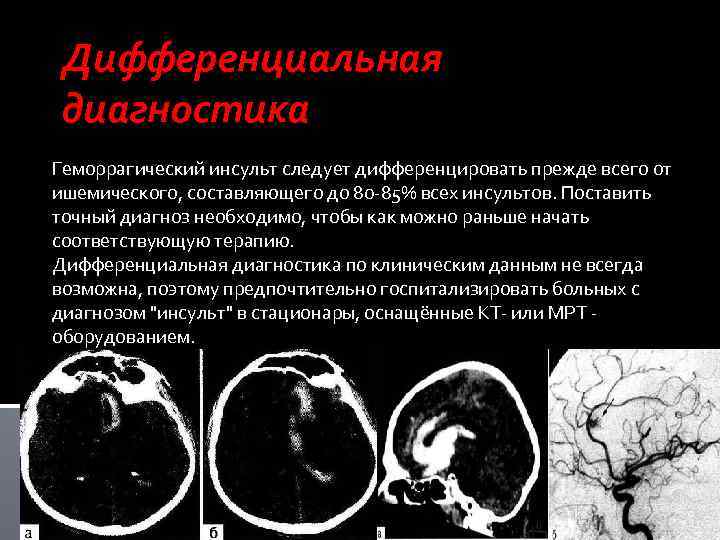 Диагностика инсульта. Геморрагический инсульт диагностика. Методы исследования при геморрагическом инсульте. Геморрагический инсульт диагноз. Геморрагический инсульт внутримозговая гематома.