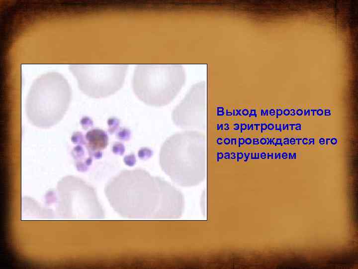 Выход мерозоитов из эритроцита сопровождается его разрушением 