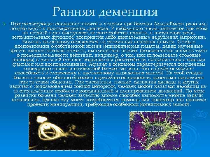 Ранняя деменция Ø Прогрессирующее снижение памяти и агнозия при болезни Альцгеймера рано или поздно