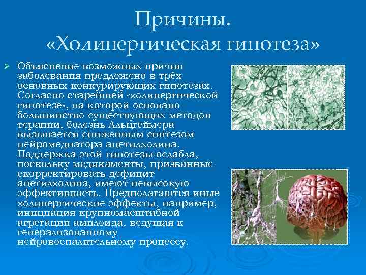 Причины. «Холинергическая гипотеза» Ø Объяснение возможных причин заболевания предложено в трёх основных конкурирующих гипотезах.