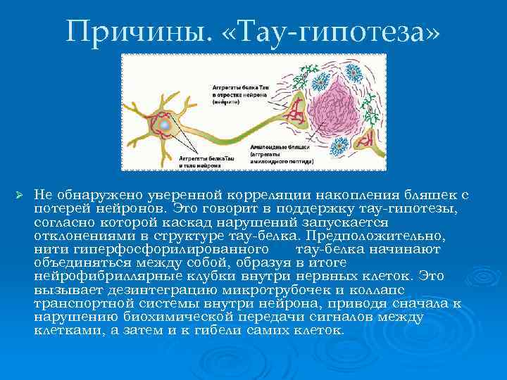 Причины. «Тау-гипотеза» Ø Не обнаружено уверенной корреляции накопления бляшек с потерей нейронов. Это говорит