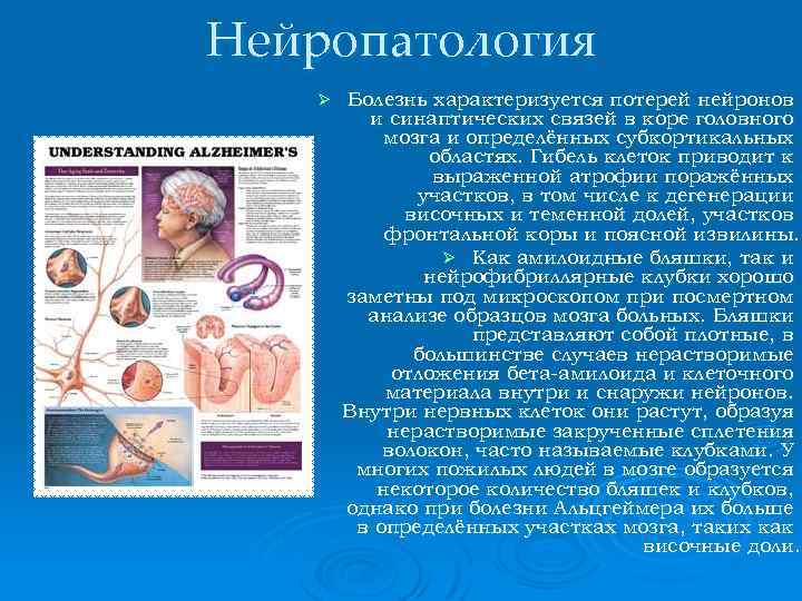 Нейропатология Ø Болезнь характеризуется потерей нейронов и синаптических связей в коре головного мозга и