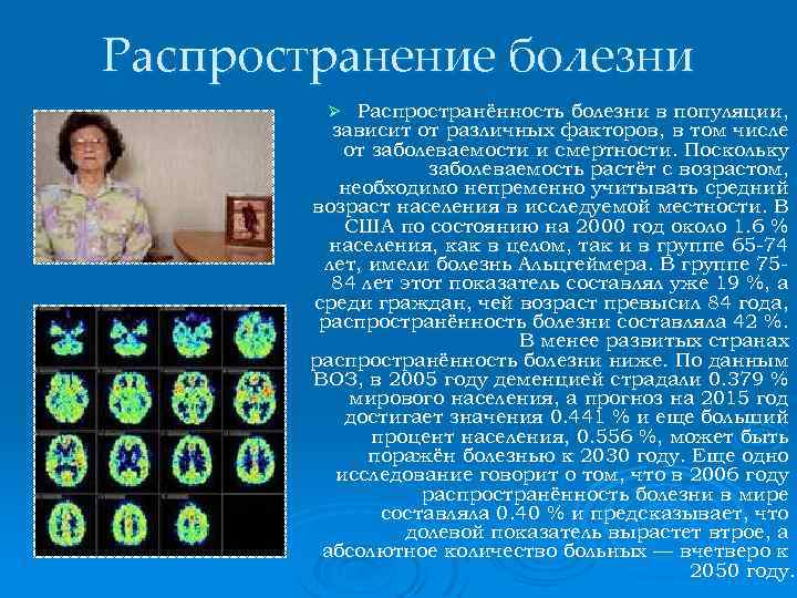 Распространение болезни Распространённость болезни в популяции, зависит от различных факторов, в том числе от