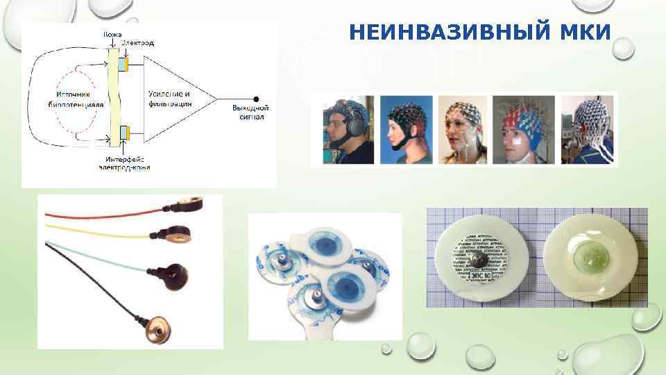 НЕИНВАЗИВНЫЙ МКИ 