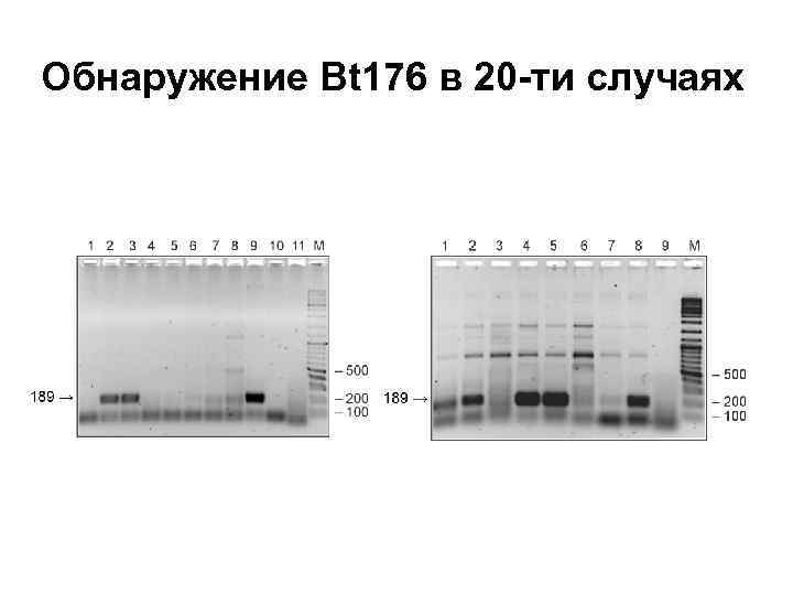 Обнаружение Bt 176 в 20 -ти случаях 